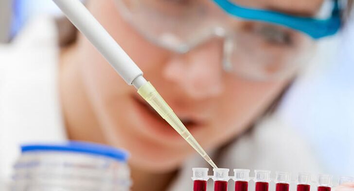 Análisis de sangre para la osteoartritis de cadera.