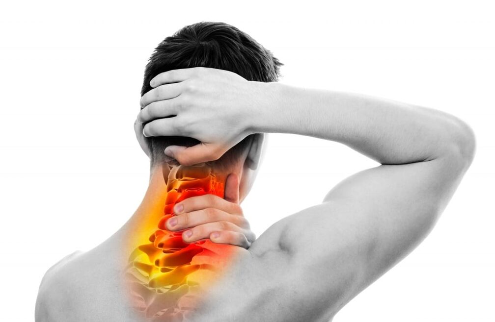 Síntomas de la osteocondrosis cervical.